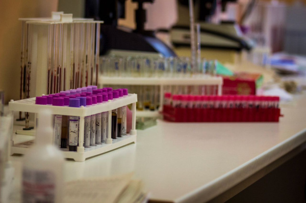 Мурманский Роспотребнадзор: в России выявлен случай лихорадки чикунгунья