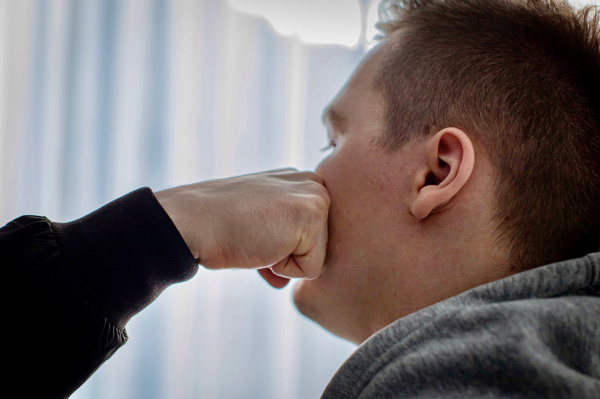 Жалобы жительницы Мурманска закончились дракой и 15 ударами битой